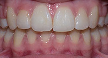 Before & Afters Before & Afters