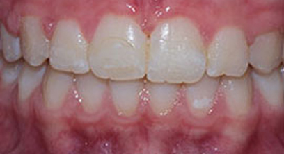 Before & Afters Before & Afters