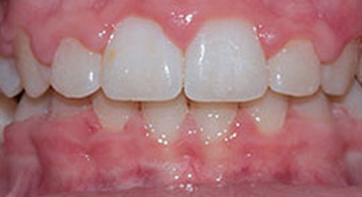 Before & Afters Before & Afters