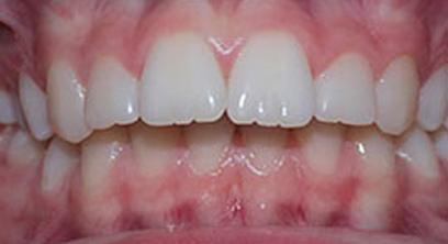 Before & Afters Before & Afters