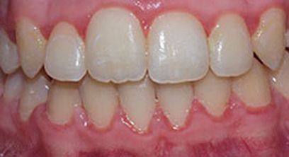 Before & Afters Before & Afters