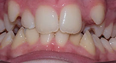 Before & Afters Before & Afters