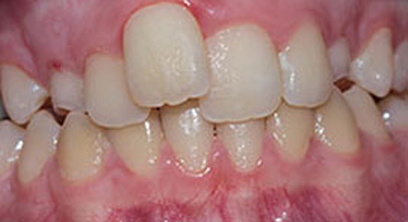 Before & Afters Before & Afters