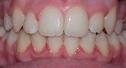 Before & Afters Before & Afters