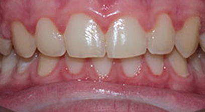 Before & Afters Before & Afters