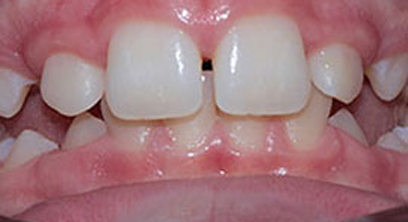 Before & Afters Before & Afters