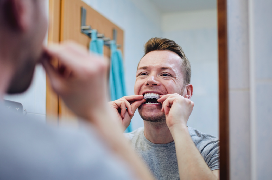 Custom orthodontic retainers Custom orthodontic retainers