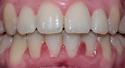 Before & Afters Before & Afters