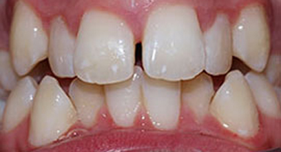Before & Afters Before & Afters