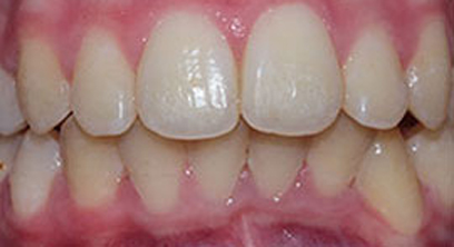 Before & Afters Before & Afters