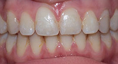 Before & Afters Before & Afters
