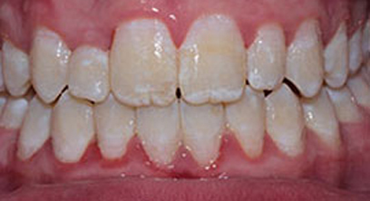 Before & Afters Before & Afters