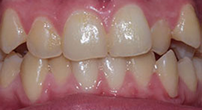 Before & Afters Before & Afters