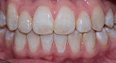 Before & Afters Before & Afters