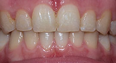 Before & Afters Before & Afters
