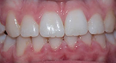 Before & Afters Before & Afters