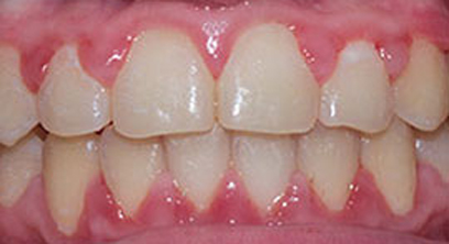 Before & Afters Before & Afters