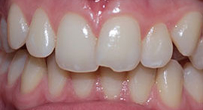 Before & Afters Before & Afters
