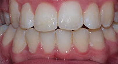 Before & Afters Before & Afters
