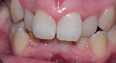 Before & Afters Before & Afters