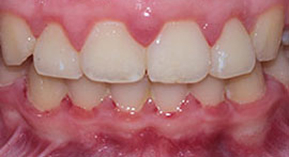 Before & After Before & After