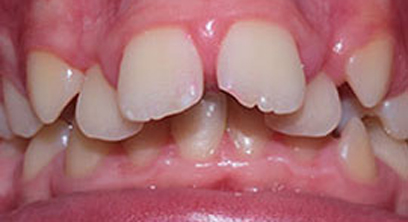 Before & After Before & After