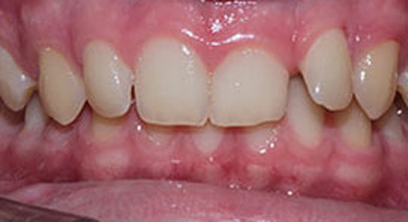 Before & Afters Before & Afters