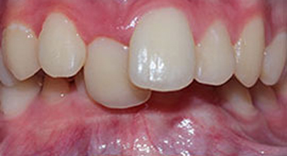 Before & Afters Before & Afters