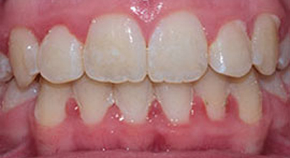 Before & Afters Before & Afters