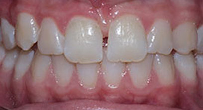 Before & Afters Before & Afters