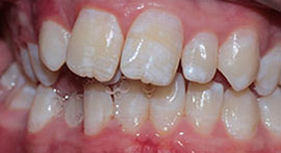 Before & Afters Before & Afters